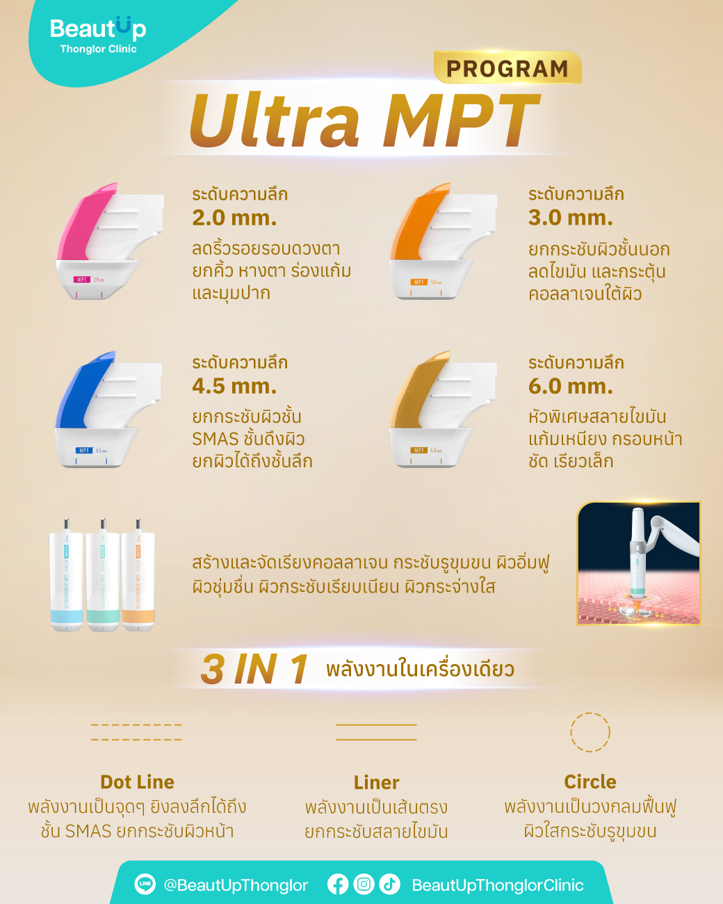Preview of Online Creative Collection — Ultra MPT 2